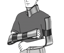 Användningsområden SAM Splint - Orange